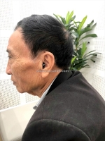 Máy trợ thính pure c&g ax – nghe hiểu lời nói dễ dàng ở các môi trường khác nhau