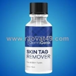 Can dermigenix skin tag remover be used on moles or warts?