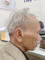 Máy trợ thính pure - máy trợ thính thẩm mỹ