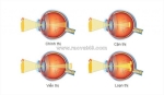 Quy trình khám và điều trị tật khúc xạ tại bệnh viện mắt sài gòn biên hòa
