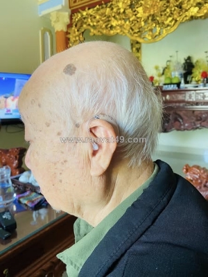 Đeo máy trợ thính có làm thính lực kém đi không?