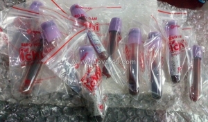 Dịch vụ chuyển mẫu bệnh phẩm động vật đi mỹ, anh, pháp, đức