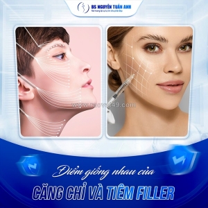 Tiêm filler: an toàn hay tiềm ẩn nguy cơ
