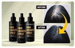 Halo grow hair spray – the ultimate solution for hair thinning