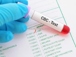 Test nhanh hiv – giải pháp kiểm tra chủ động thời đại mới
