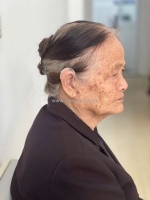 Lắp đặt máy trợ thính chính hãng nam định