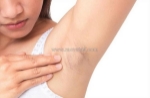 Cách điều trị lông nách mọc đôi hiệu quả và những lưu ý quan trọng