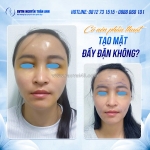 Tướng mặt tròn đầy đặn