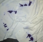 Hóa chất tẩy mực trên đồ vải