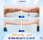 Tay thon – nách gọn: bí quyết diện đồ đẹp không cần che giấu