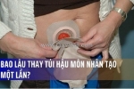 Bao lâu thay túi hậu môn nhân tạo một lần?
