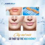 Cấy mỡ môi trên