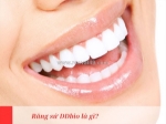 Giá máy làm trắng răng trên thị trường là bao nhiêu?