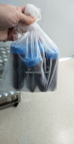 Gửi mẫu  bệnh phẩm đi thái lan, đài loan giá rẻ, uy tín