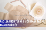 Hệ thống túi hậu môn nhân tạo hai mảnh