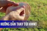 Hướng dẫn thay túi hmnt
