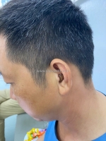 Máy trợ thính trong tai bí mật dành cho người trẻ tuổi