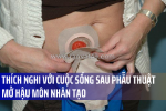 Thích nghi với cuộc sống sau phẫu thuật mở hậu môn nhân tạo (p1)