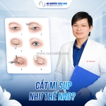 Cắt mí có thay đổi vận mệnh không
