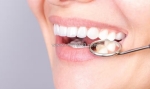 Chữa lợi trùm răng khôn ở đâu tốt?