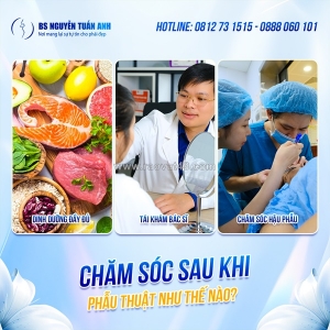 Mở góc mắt trong: ai phù hợp, khi nào nên thực hiện