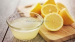 Niềng răng lộn xộn hết bao nhiêu tiền? bảng giá cập nhật mới nhất