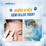 Tiêm filler trán và ảnh hưởng đến nhân tướng học