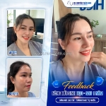 Giải pháp cho diện mạo thanh thoát và tự tin hơn