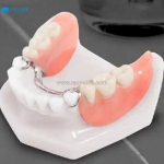 Giám định thương tật khi rụng 2 răng cửa vĩnh viễn