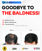 How to use calvistop spray reviews and get the best results?