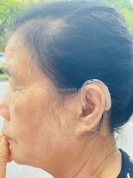 Máy trợ thính kỹ thuật số giảm tiếng ồn