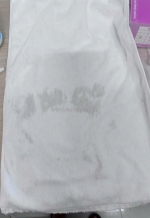 Xử lý vết thâm đen trên khăn trắng