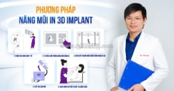 Giải pháp tạo dáng mũi chuẩn cá nhân hóa