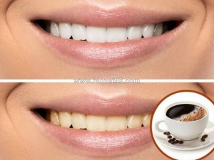 Hướng dẫn chuyên sâu về các cách làm trắng răng sau 1 đêm tại nhà an toàn và hiệu quả