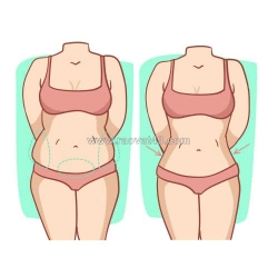 Hút mỡ bị lồi lõm có chỉnh sửa được không?