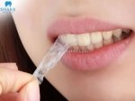 Miếng dán trắng răng có hiệu quả không? phân tích cơ chế và hướng dẫn sử dụng an toàn