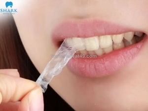 Miếng dán trắng răng có hiệu quả không? phân tích cơ chế và hướng dẫn sử dụng an toàn