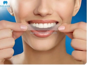 Miếng dán trắng răng: giải pháp kiến tạo nụ cười rạng rỡ tại nhà