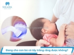 Tẩy trắng răng trong giai đoạn cho con bú: có nên thực hiện và cần lưu ý gì?