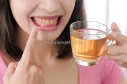 Uống trà có bị vàng răng không và giải pháp bảo vệ nụ cười