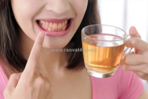 Uống trà có bị vàng răng không và giải pháp bảo vệ nụ cười