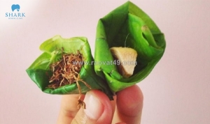 Vì sao ăn trầu hay ra hiện tượng răng dễ xỉn màu