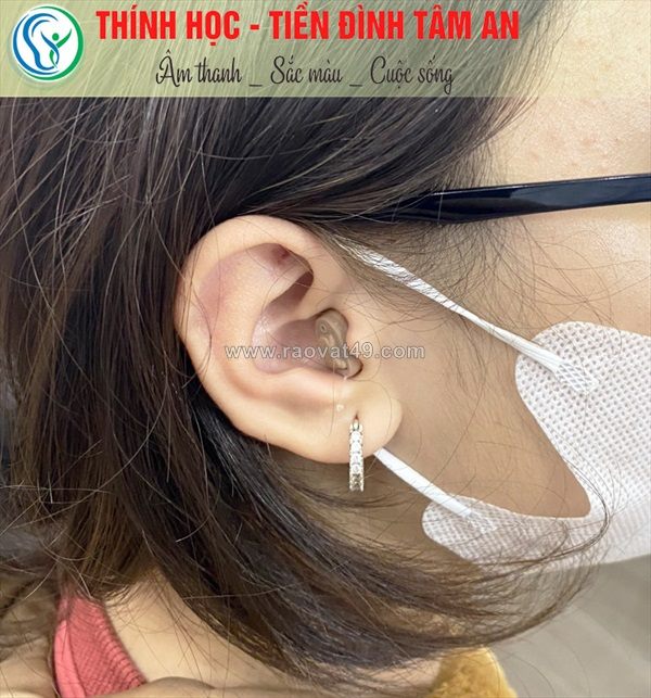 Máy trợ thính insio cic - máy trợ thính thẩm mỹ