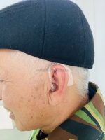 Khi tiếng ù tai không còn là nỗi ám ảnh nhờ máy trợ thính hiện đại