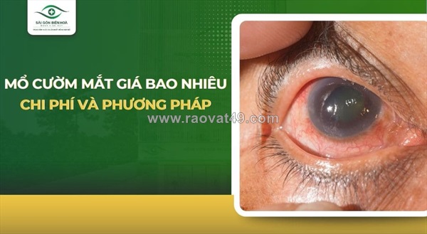 Bảng giá chi phí mổ cườm mắt tại bệnh viện mắt sài gòn biên hòa