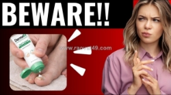 Dermafix nagelpilz-gel-ratgeber – für mehr nagelstärke und klarheit