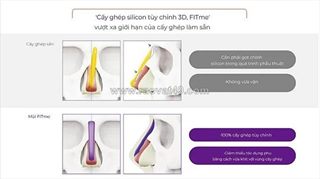 Nâng mũi 3d fitme có đặc điểm gì nổi bật?