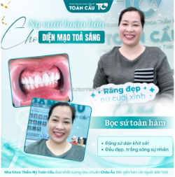 Bọc răng sứ có cần lấy tủy không? trường hợp nào bắt buộc, trường hợp nào không