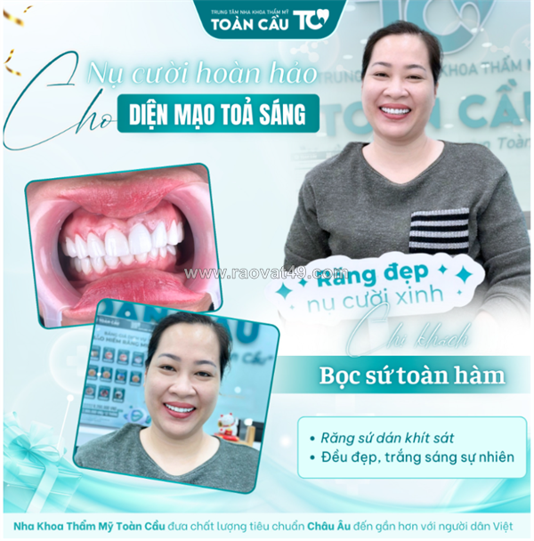 Bọc răng sứ có cần lấy tủy không? trường hợp nào bắt buộc, trường hợp nào không