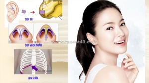 Làm gì khi đầu mũi bị co rút? giải pháp an toàn từ chuyên gia